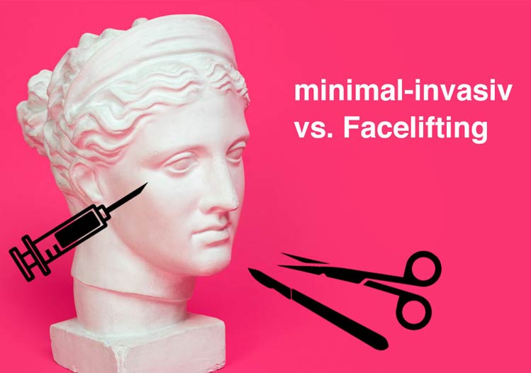 minimal-invasiv Facelifting
